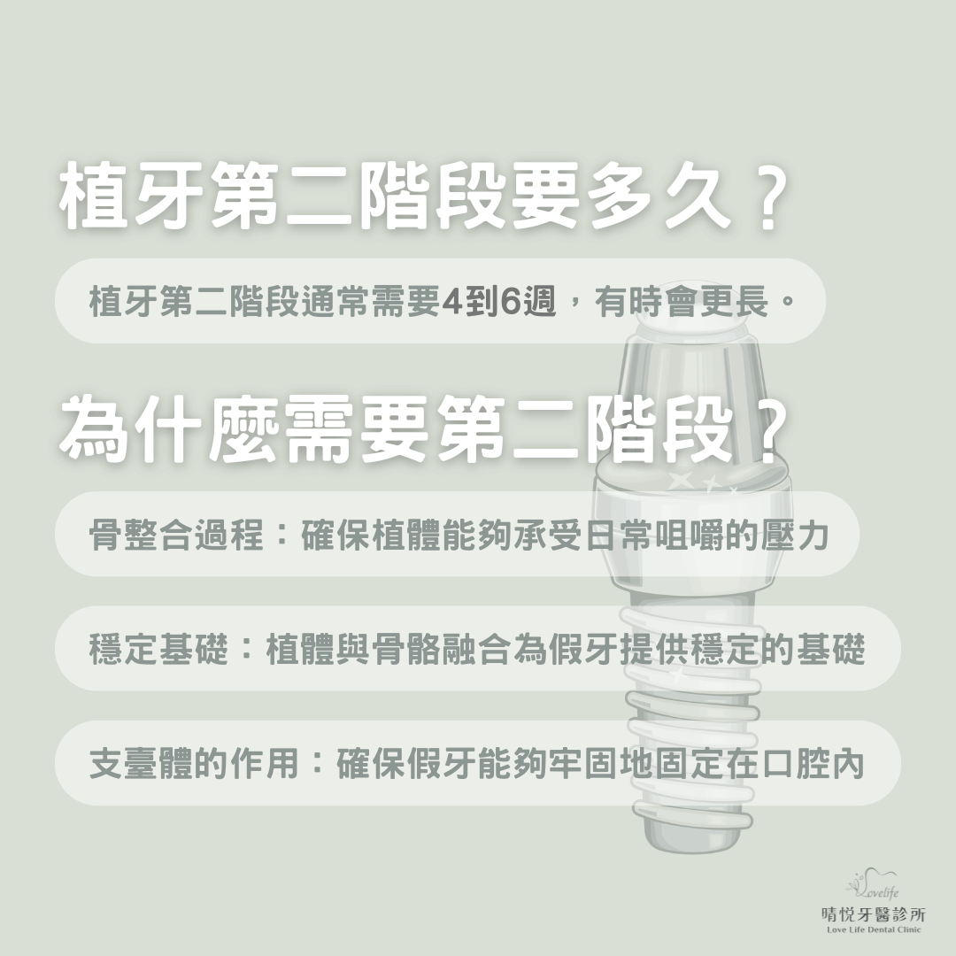 植牙第二階段要多久？為什麼需要第二階段？