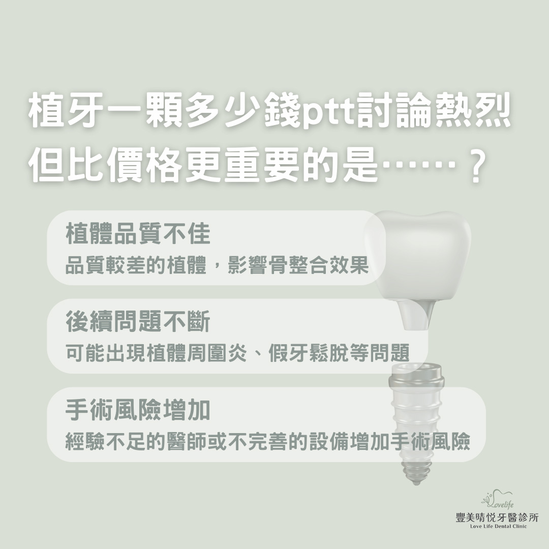 植牙一顆多少錢ptt討論熱烈,但比價格更重要的是……?