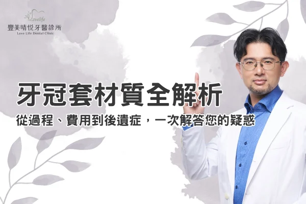 牙冠套材質全解析